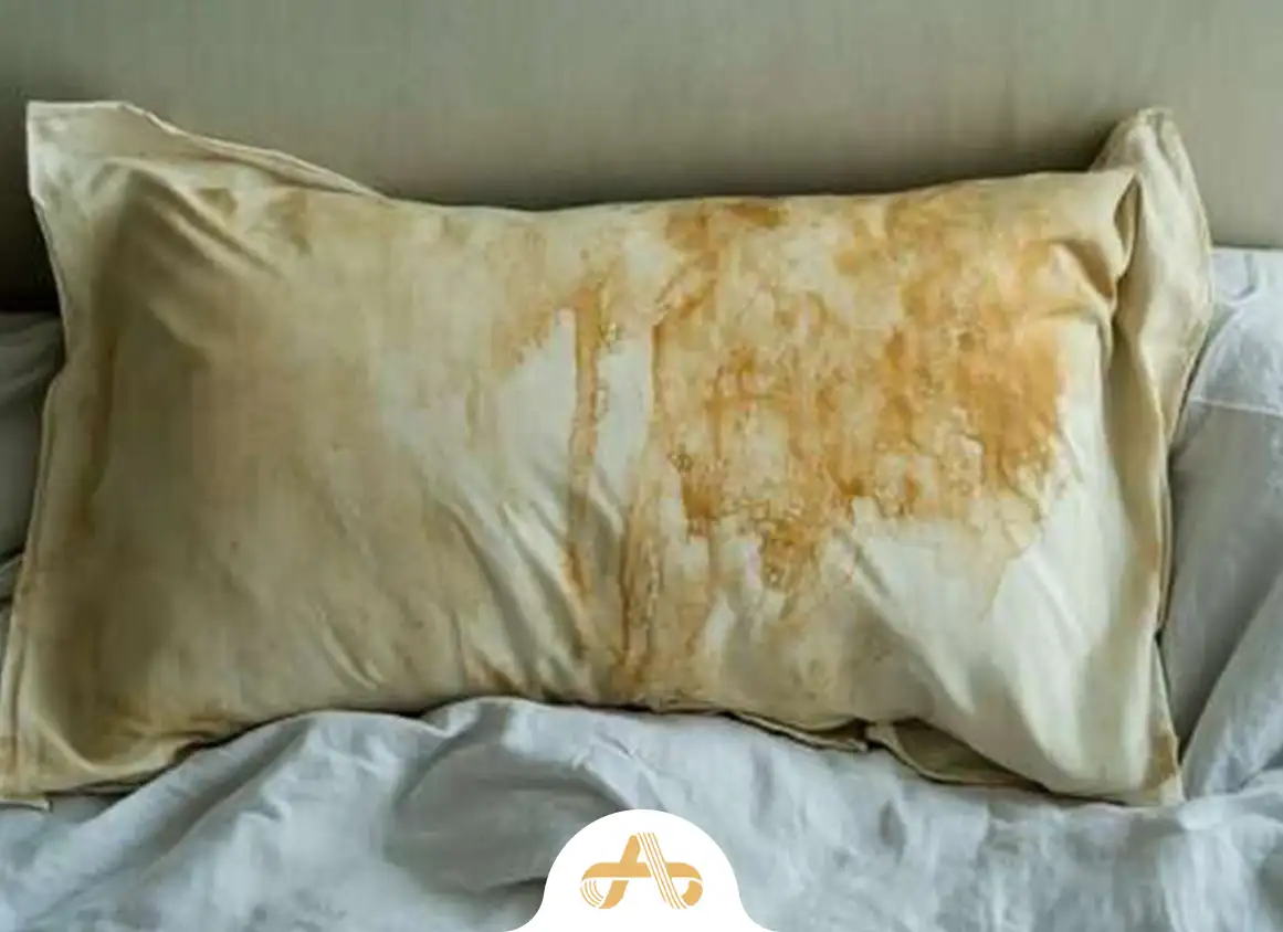 ترفندهایی برای رفع زردی ملحفه سفید